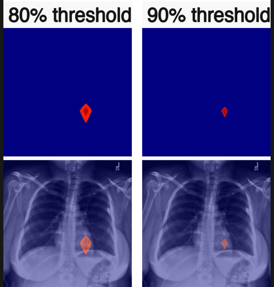 Grad-CAM++ activation regions at 80 percent and 90 percent of the heatmap maximum, overlaid on a chest X-ray.