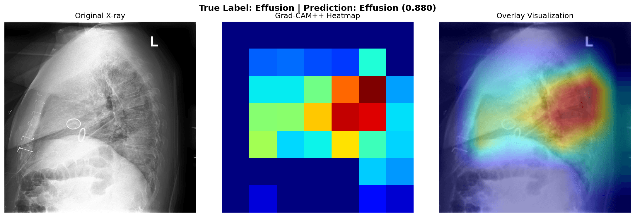 Lateral chest X-ray with its Grad-CAM++ heatmap and overlay, showing activation in the posterior lower region.