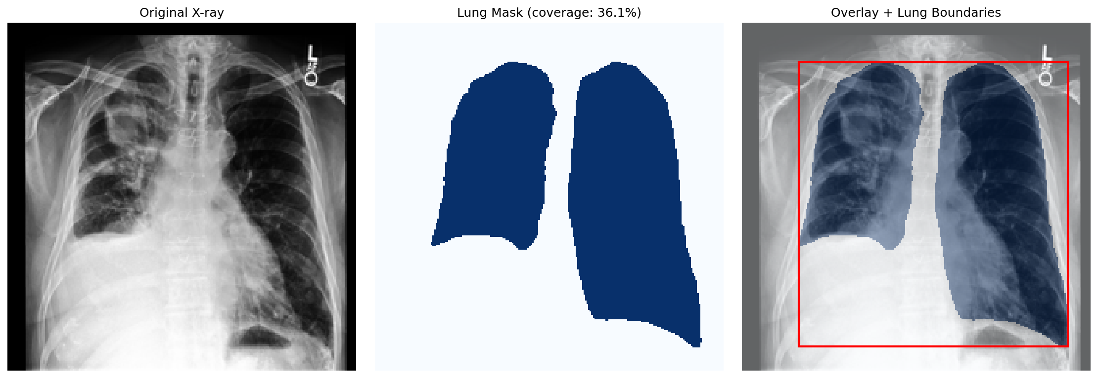 Three panels: the original frontal chest X-ray, the binary lung mask produced by PSPNet, and the X-ray overlaid with the lung boundary and bounding box.