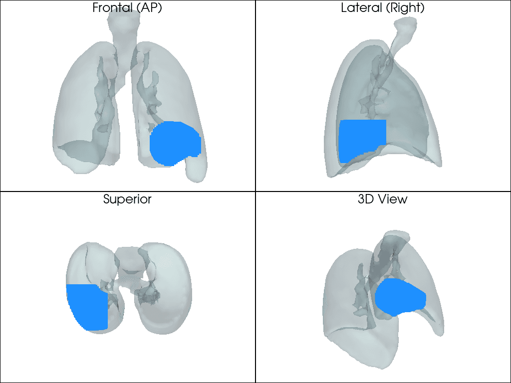 Four views of a 3D lung model (frontal, lateral, superior and perspective) with a blue point cloud rendered inside the lung at its lower, posterior region.